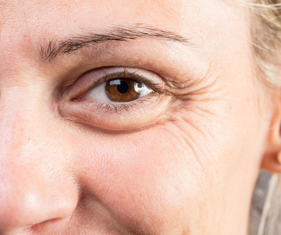Wrinkles/Fine Lines Treatments at BGS